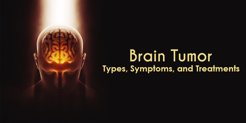 Brain Tumor Types categorized , Symptoms, and Treatments