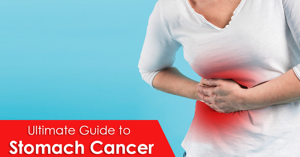 Ultimate Guide to Stomach Cancer - University Cancer Centers