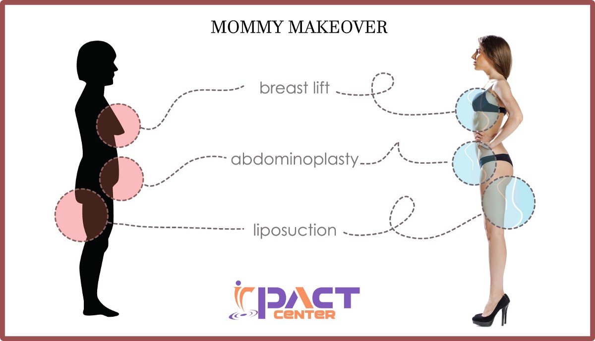 Get Your Pre-Pregnancy Shape Back With Mommy Makeover